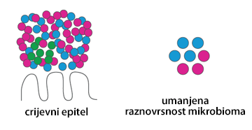 Mikrobiom crijeva žena sa PCOS